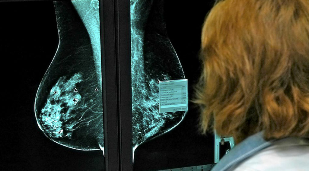 Mamografia luz infrarroja